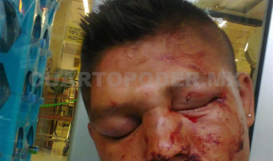 Así, con los ojos y la boca cerrados por los puñetazos, quedó un joven ebrio. A. Alegría / CP