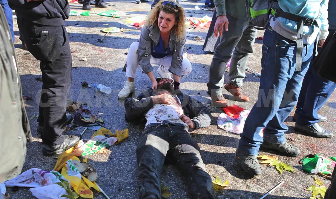 El ataque en Turquía dejó un total de 86 muertos y 186 heridos. AP
