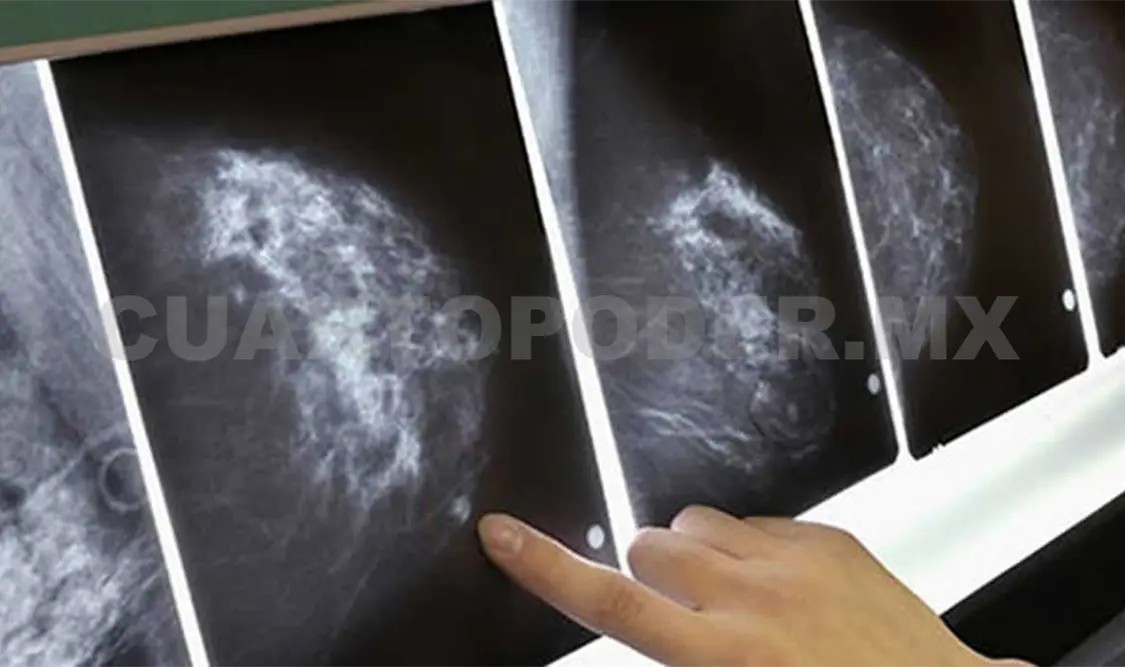 Lucha contra cáncer es posible, con información