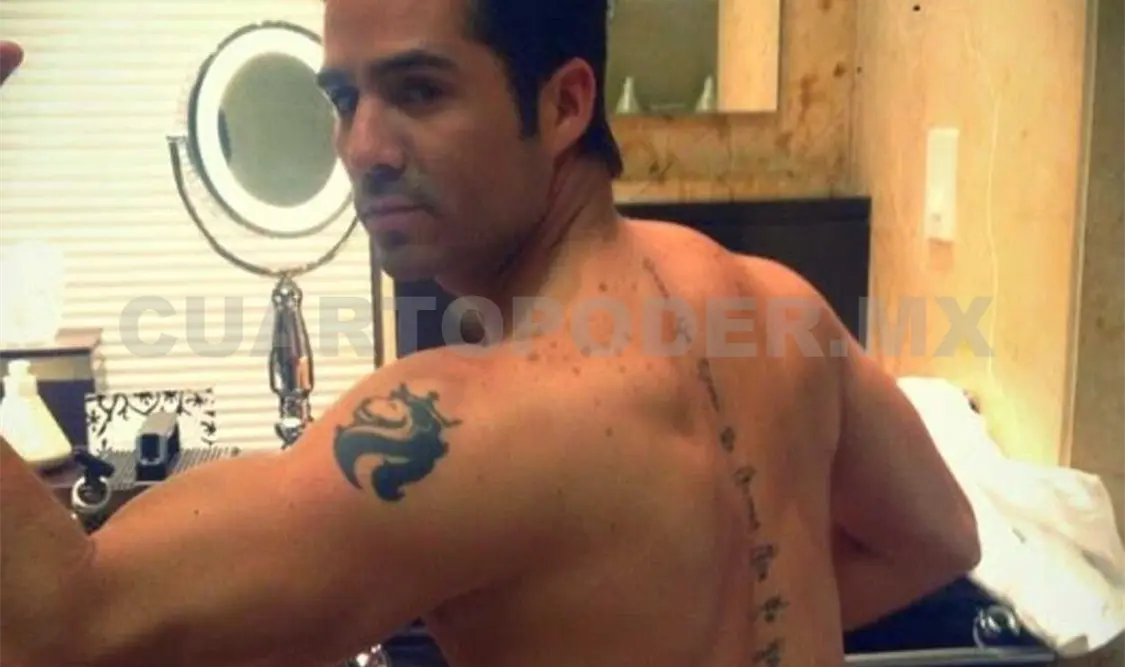 José Ron borra sus tatuajes