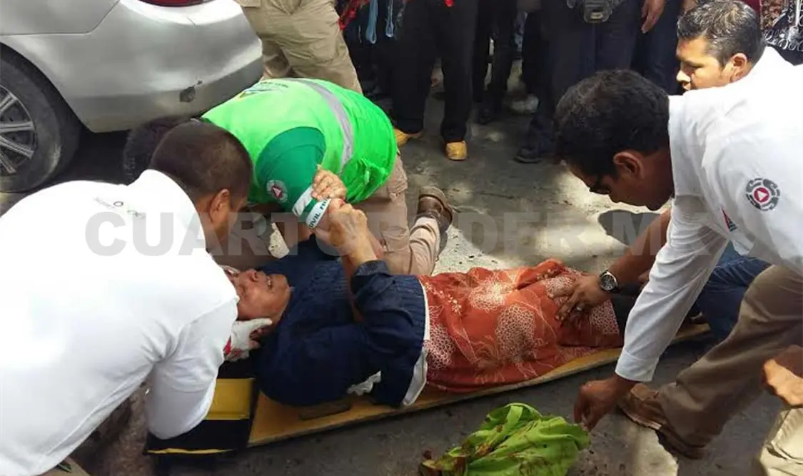 Una mujer resultó lesionada luego de ser arrollada por un auto en el centro de la capital. Rafael Cabrera / CP