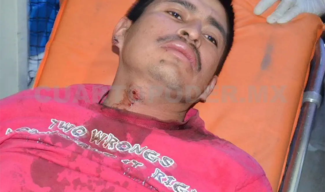 Un campesino fue herido de un balazo en el cuello mientras trabajaba, en el municipio de La Trinitaria. Flor Cordero / CP