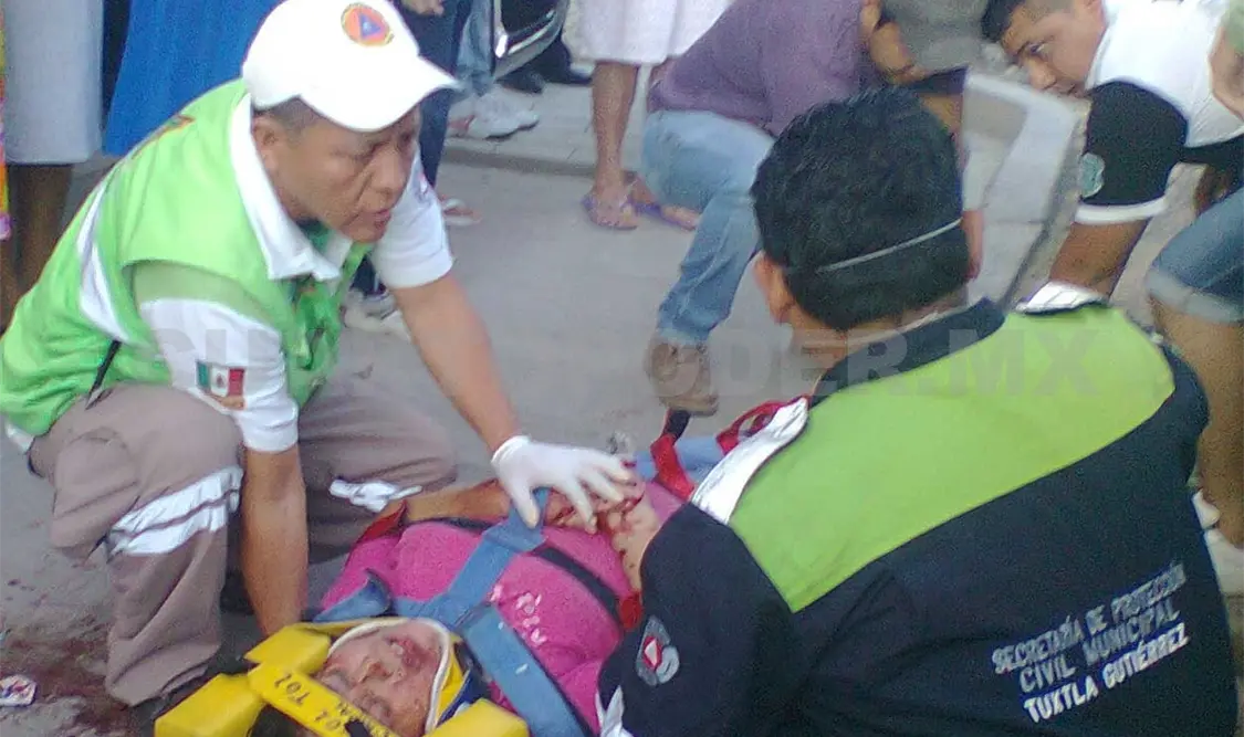 Mujer herida por resistirse al robo