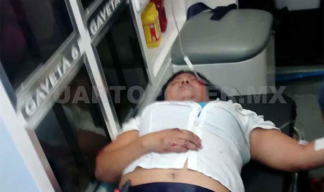Madre e hija lesionadas al caer de motocicleta