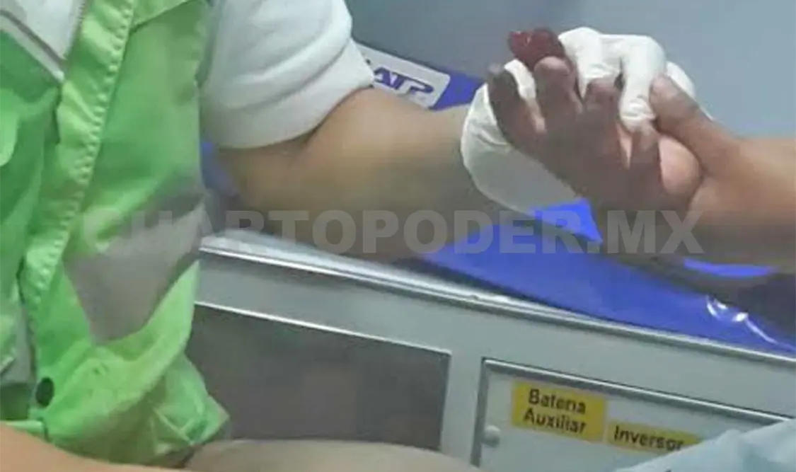 Explota cohetón en mano de un niño