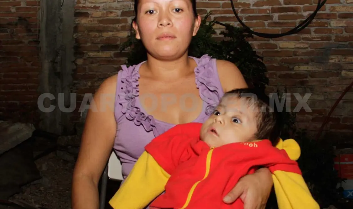 Desde su nacimiento, Cristián ha padecido esta rara enfermedad . Miguel Ballinas / CP