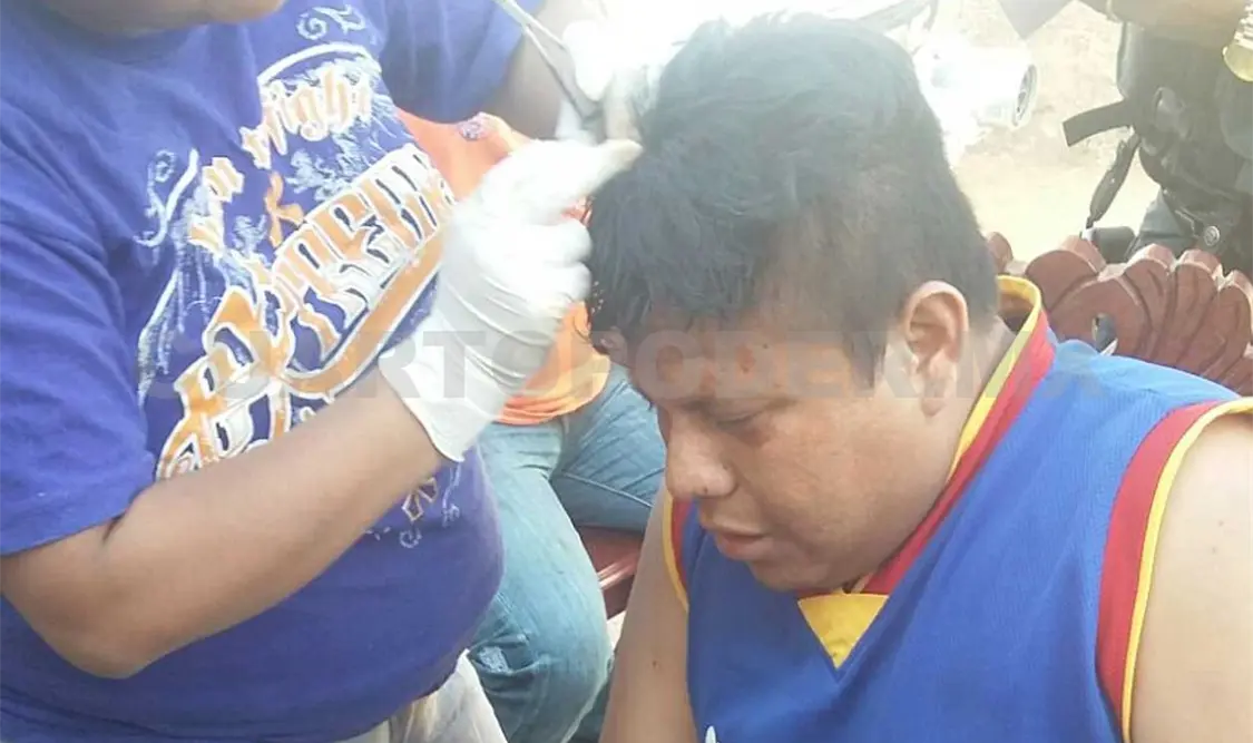 Los hombres terminaron con heridas en la cabeza y el rostro.