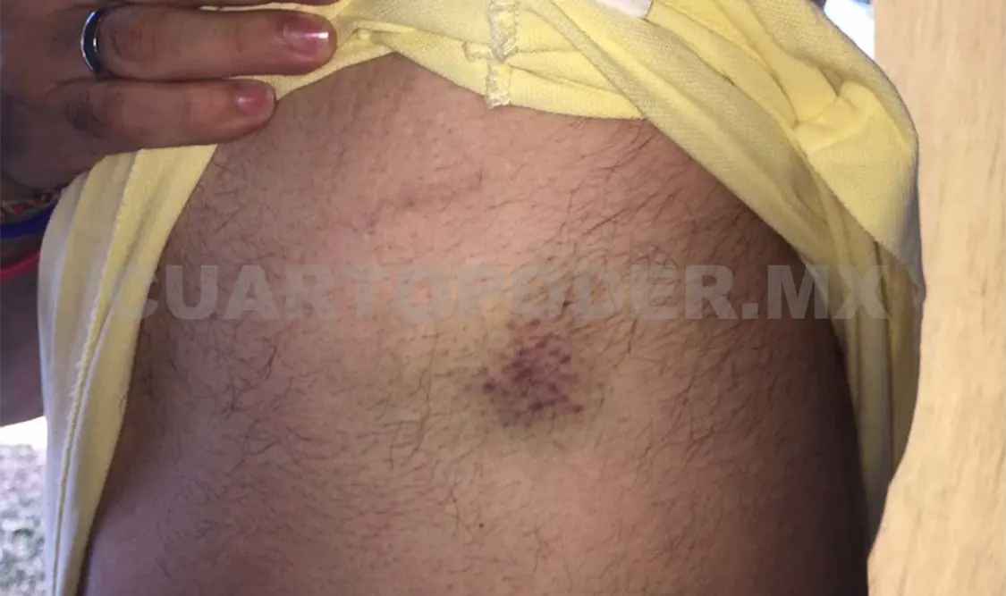 Golpes y violaciones a derechos humanos