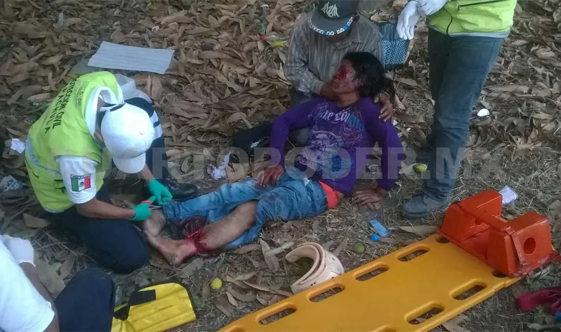 Grave, tras ser atropellado en la carretera