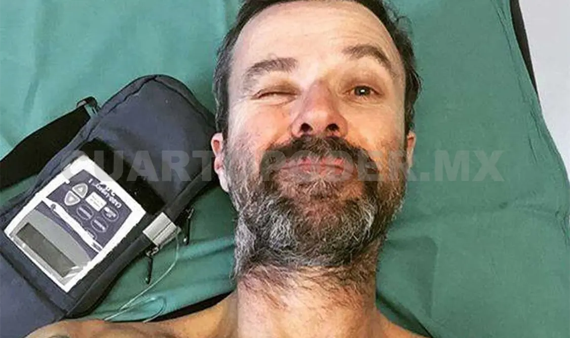 Vocalista de Jarabe de Palo sigue en la batalla