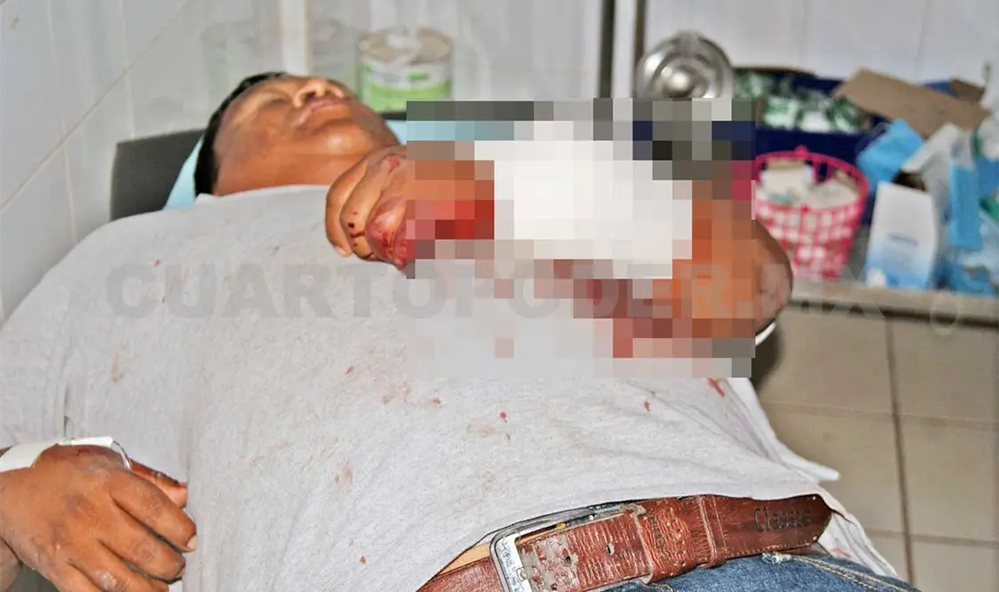 Asaltantes machetean a obrero en carretera