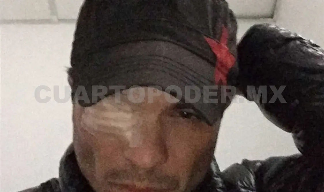Kuno Becker se queda ciego por maquillaje corriente