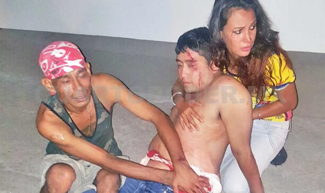 Desconocido ataca a joven frente a su novia