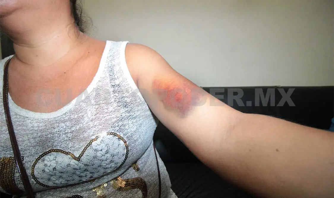 Acusan abuso de policías en Suchiapa