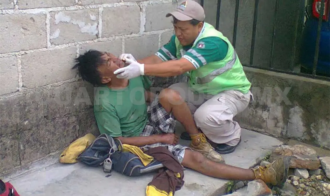 José Alfredo fue herido en el rostro por compañeros de parranda. A. Alegría / CP