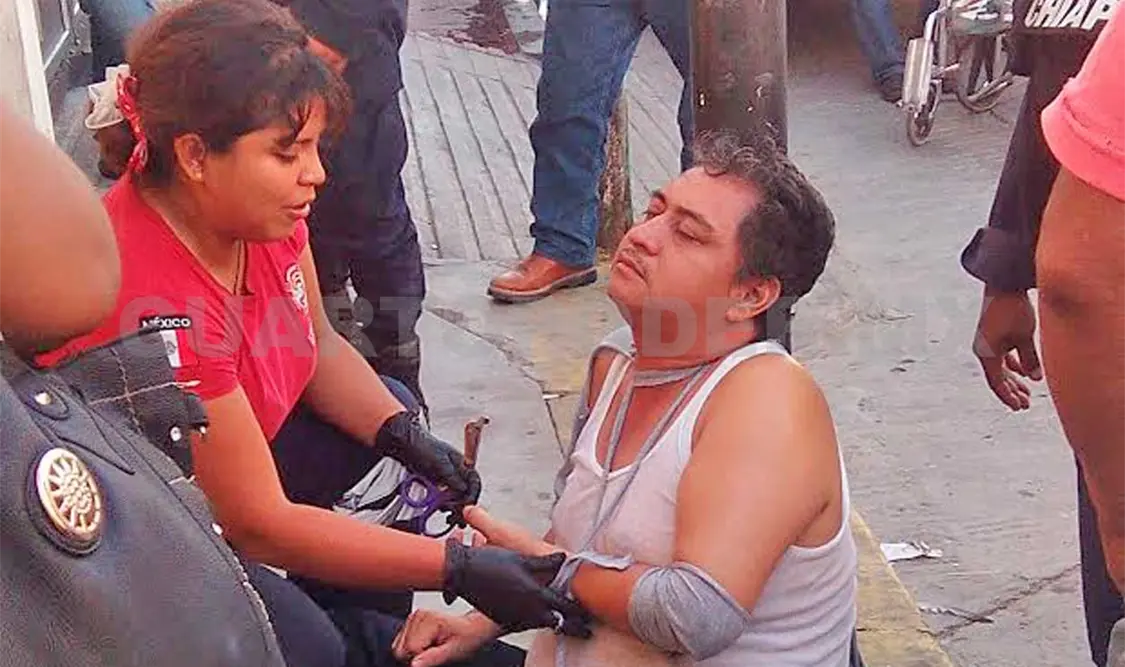 Le zafaron el hombro en una riña callejera