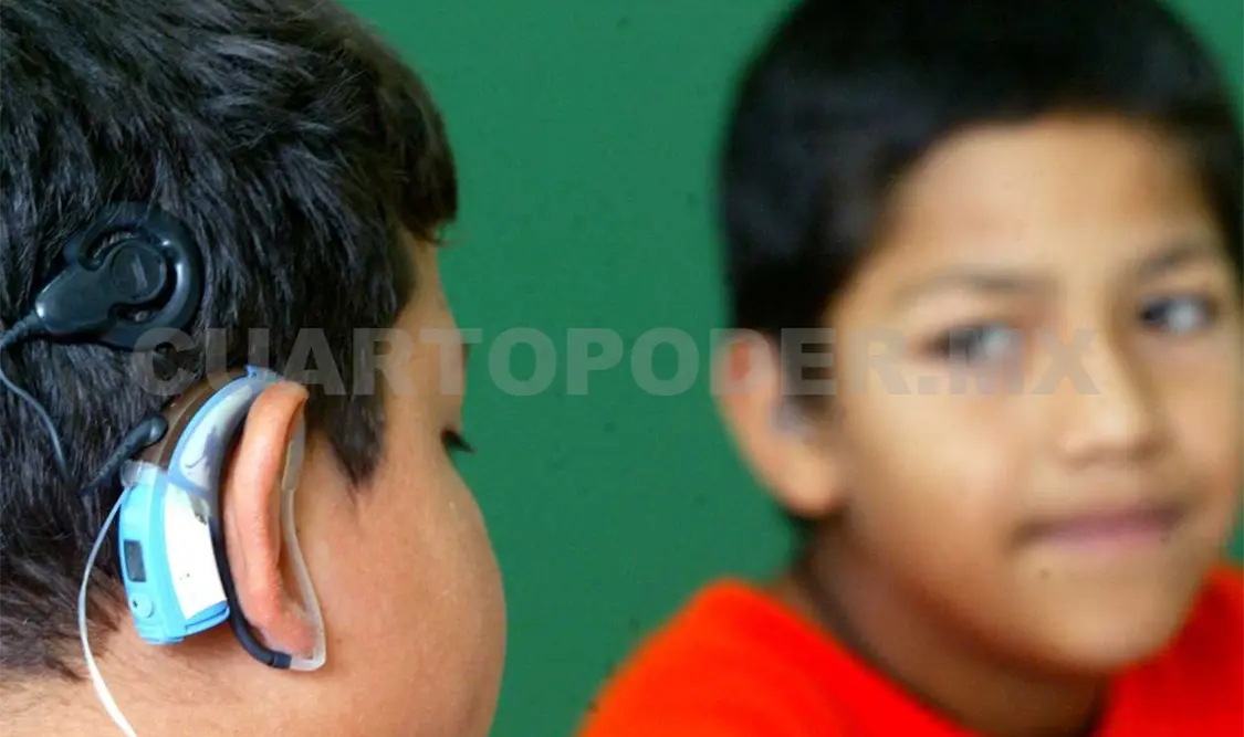 El objetivo del implante coclear es mejorar la calidad de vida de personas con sordera. Agencias