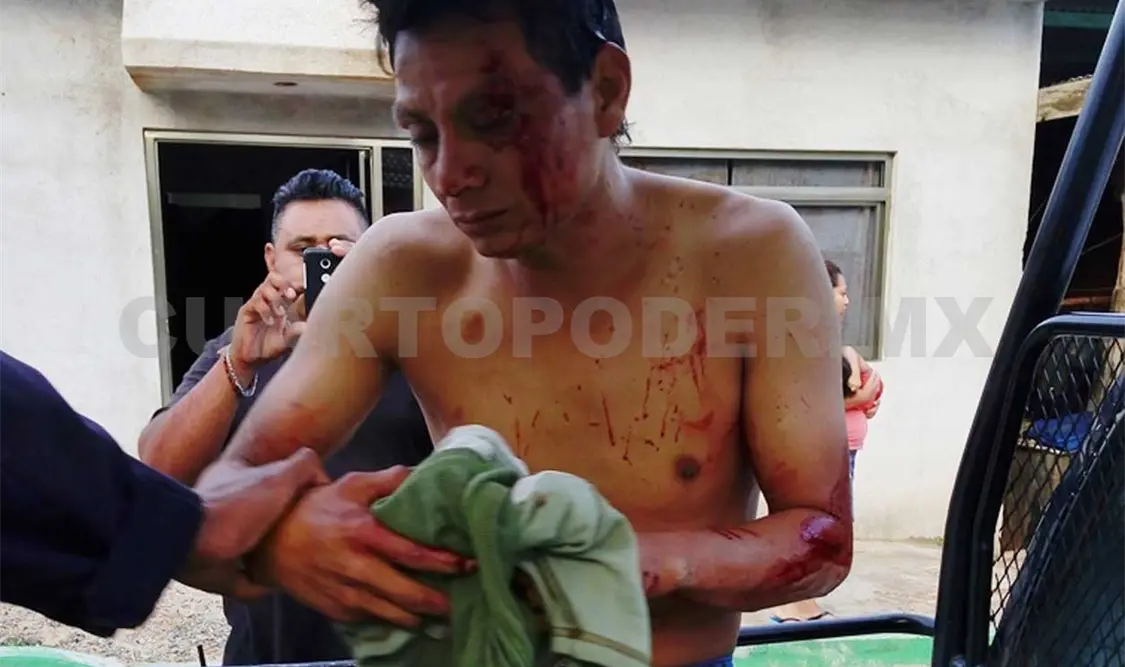 Colonos tunden a golpes a presunto delincuente