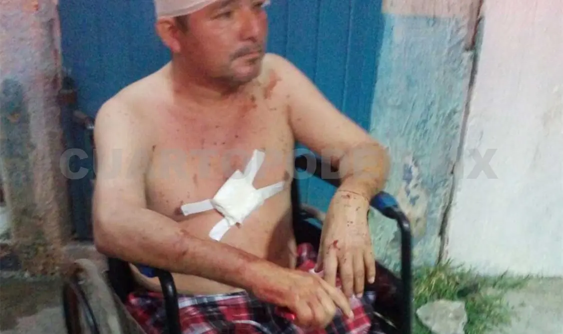 Sujetos ebrios hieren y golpean a su papá