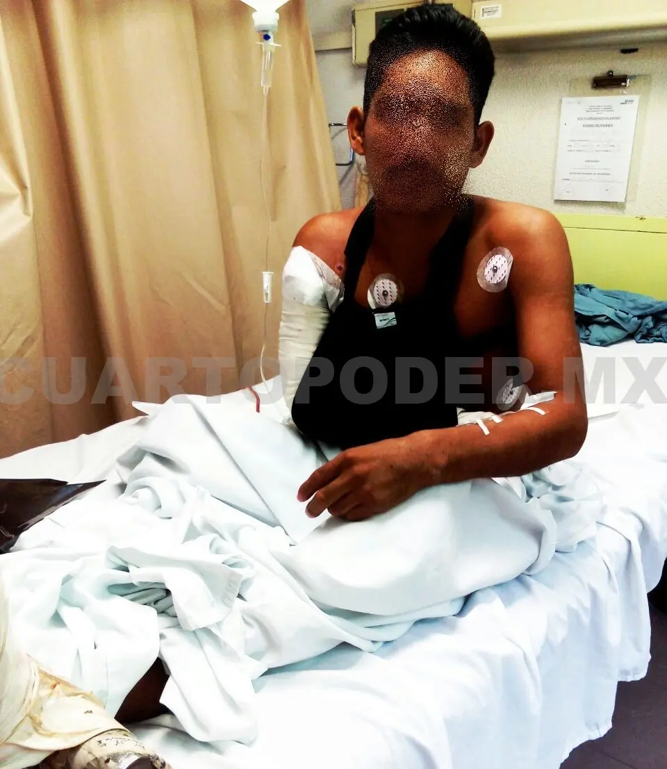 El migrante está siendo atendido en el Hospital General de Tapachula. Cortesía.