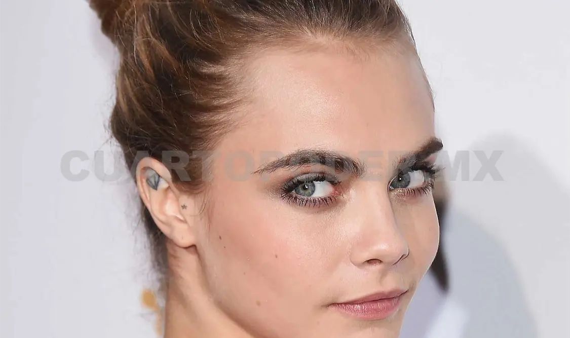 A Cara Delevingne se le despelleja la piel