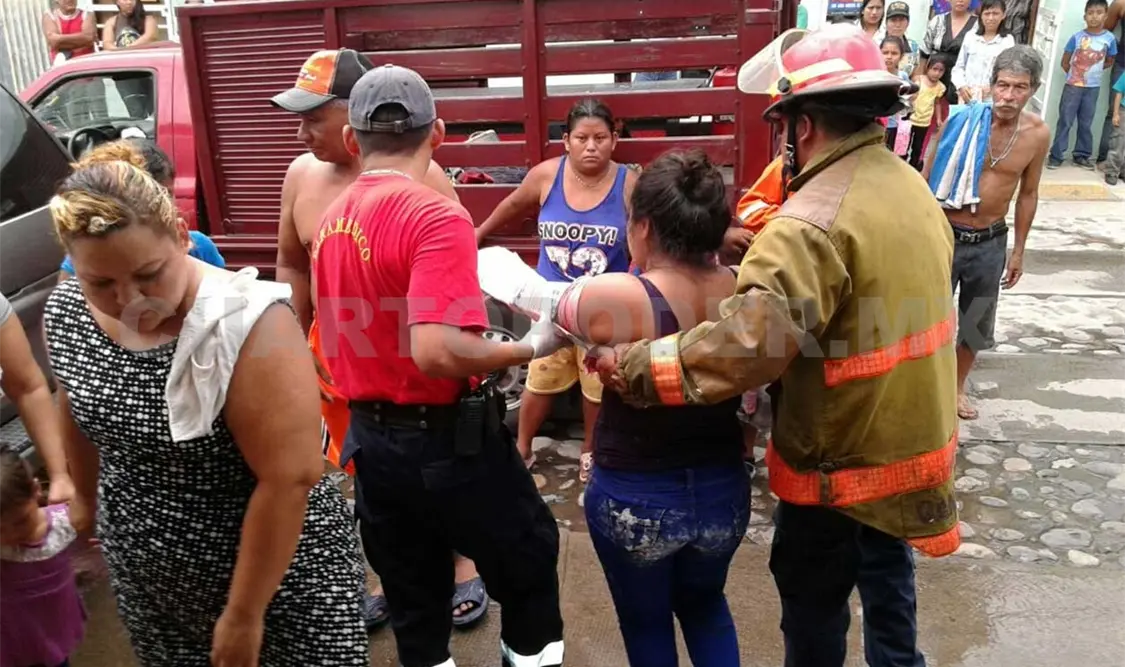 Salvan a mujer; su mano estaba atascada