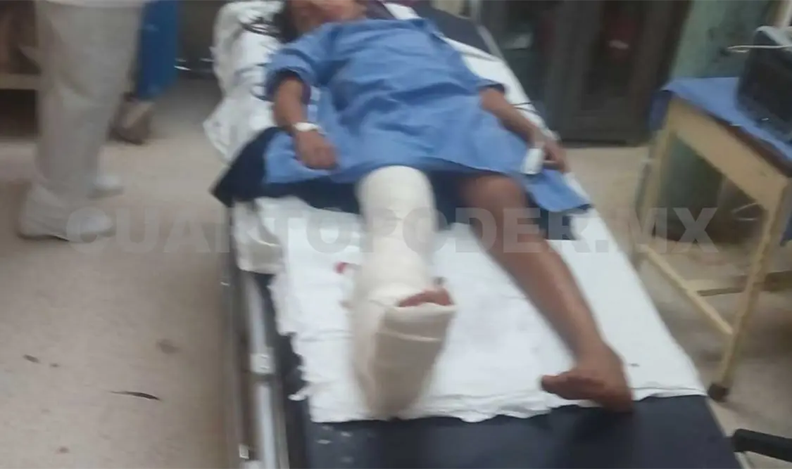 Niña atropellada por una camioneta