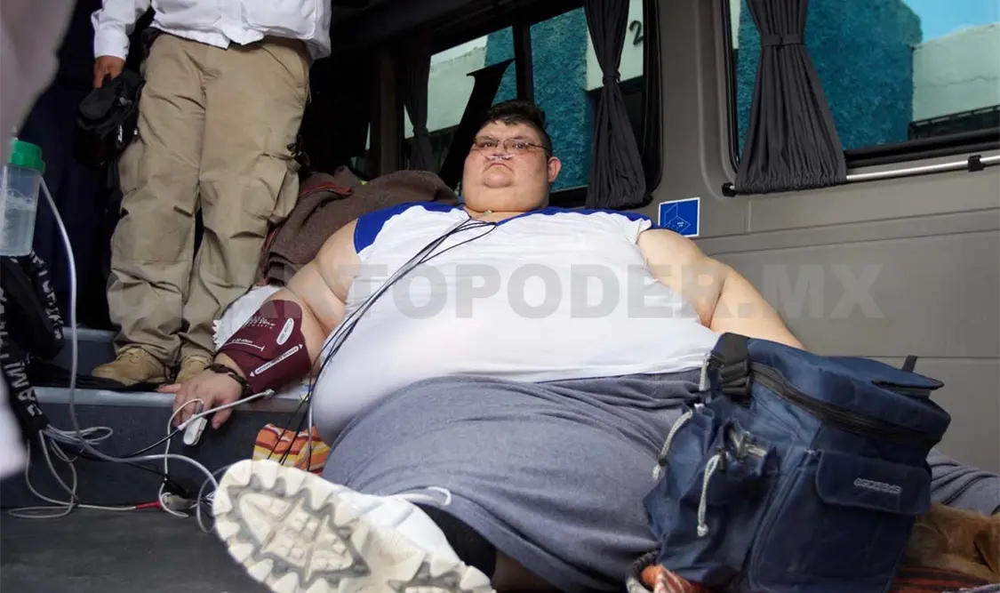 Operarán al hombre más obeso del mundo