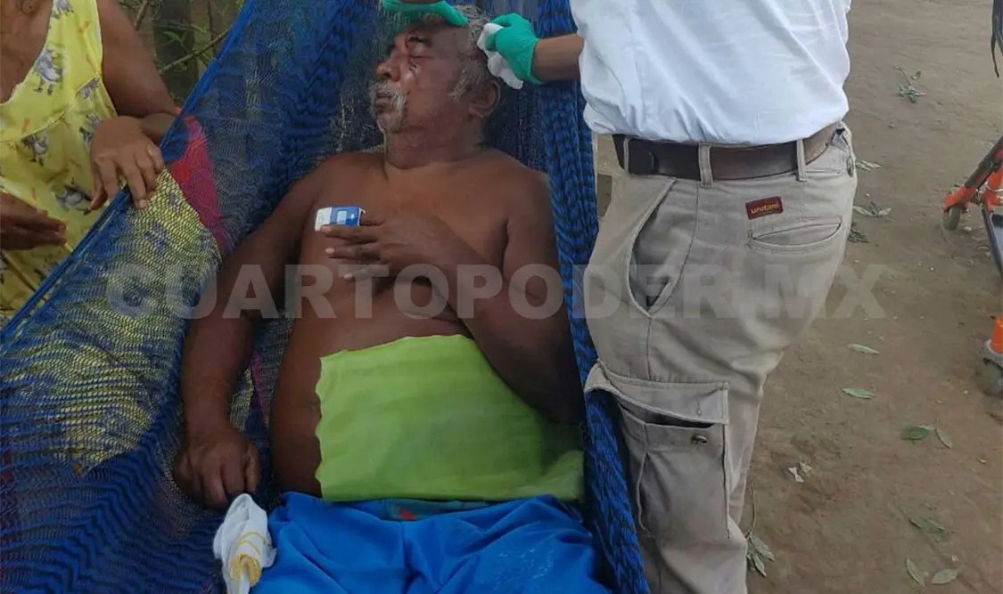 Cae hombre a fogón