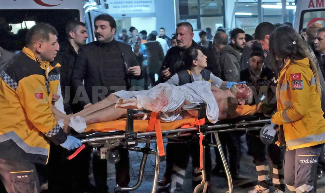 Al menos treinta personas resultaron heridas en una doble explosión cerca de un estadio de futbol en la capital turca. Agencias