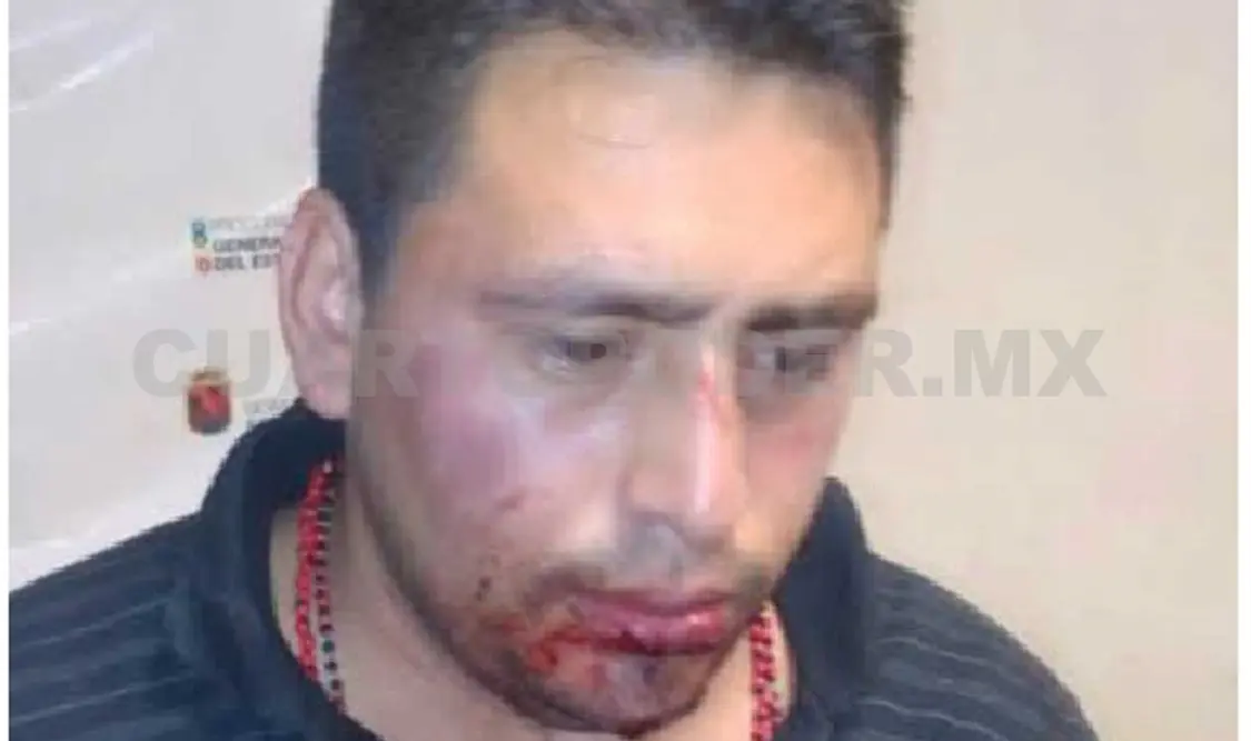 Herido de 2 balazos, policía detiene a un delincuente