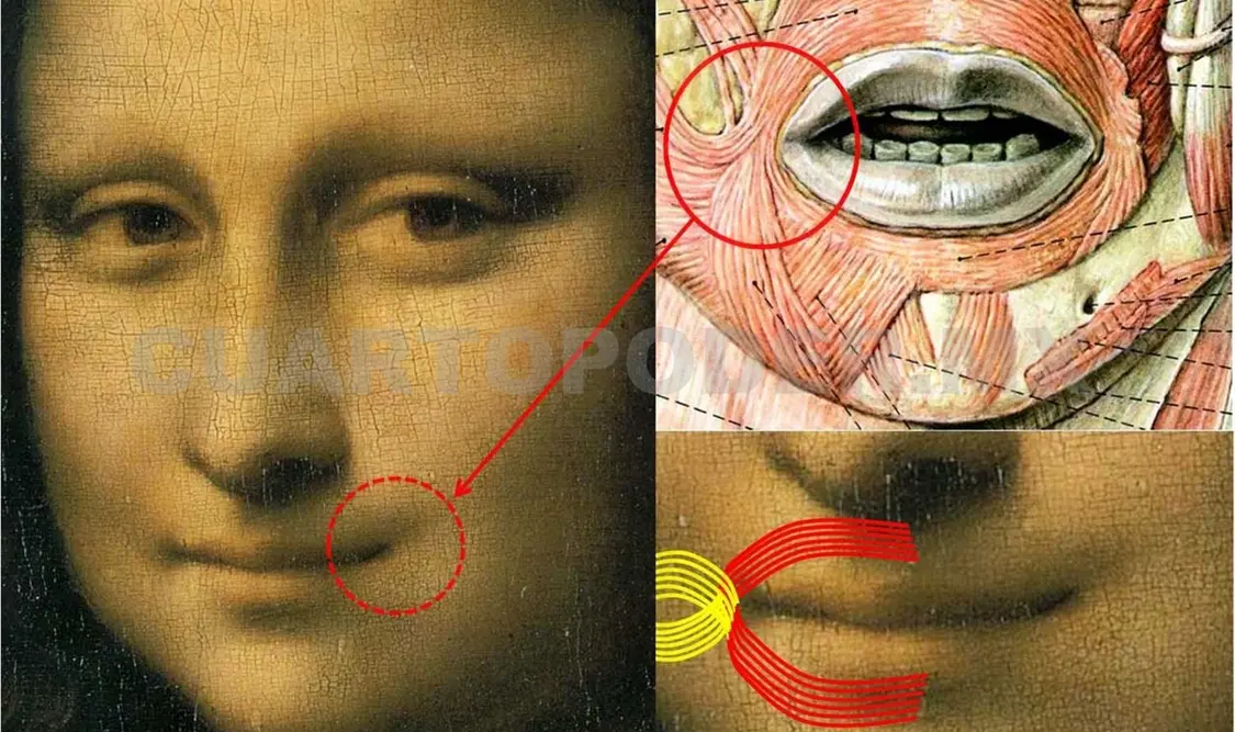 ¿La Mona Lisa padecía sífilis?