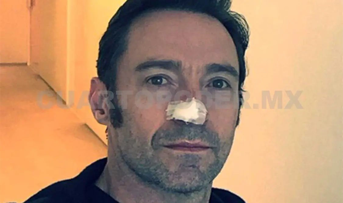 Hugh Jackman, sometido a otra cirugía