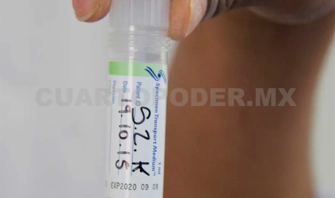 Se fortalece salud de la mujer con pruebas para la detección del VPH