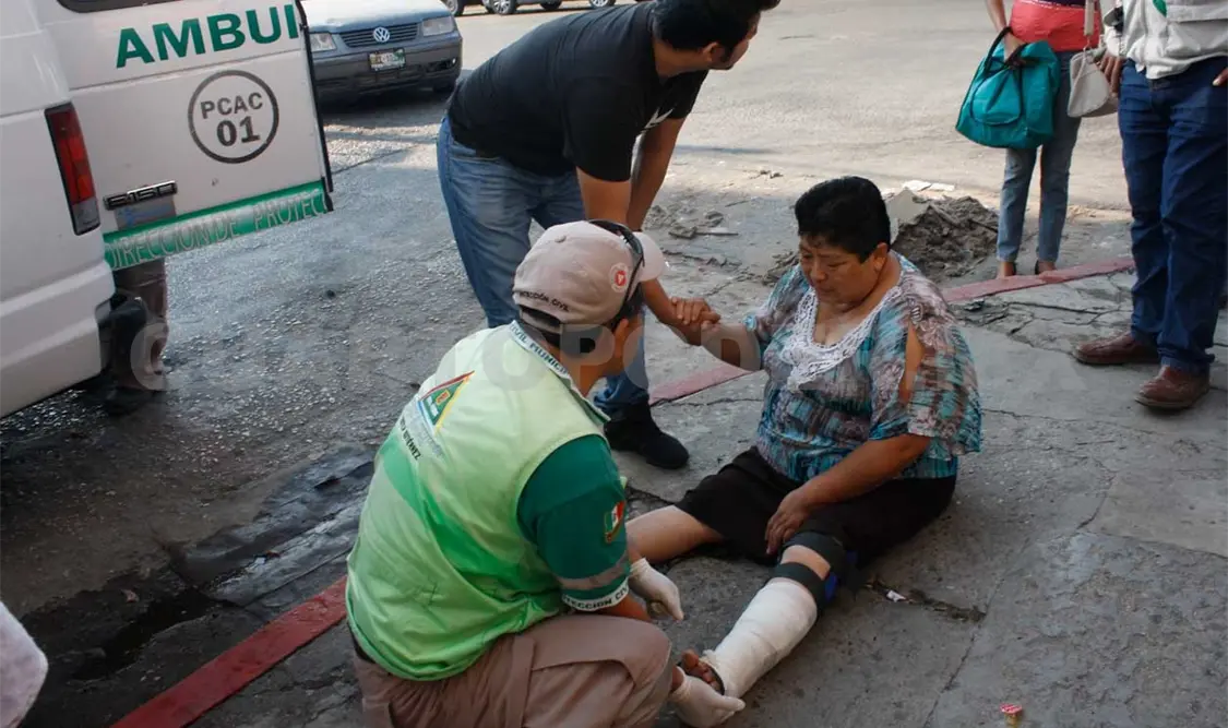 Mujer se fractura su pierna con su propio peso