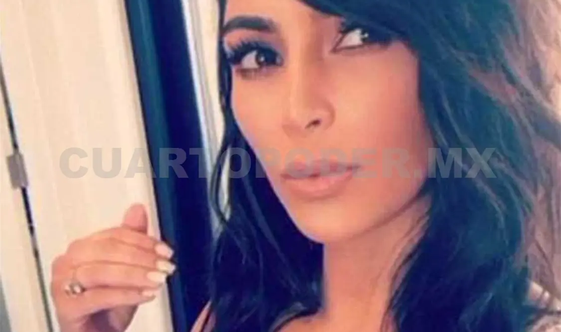 Kim Kardashian se someterá a operación