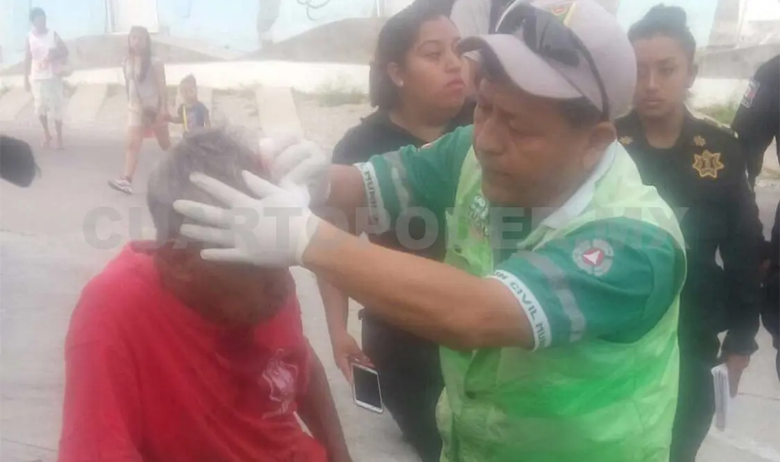 Demente golpea con tubo a peatón