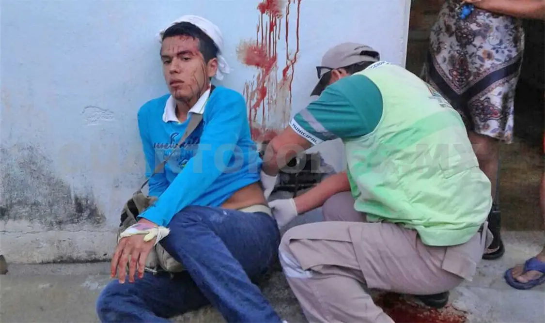 Joven herido en asalto matutino