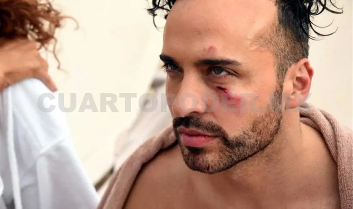 Integrantes de Kabah sufren accidente