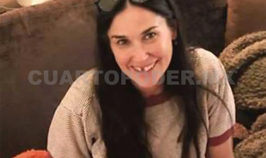 Demi Moore perdió dos diente por estrés