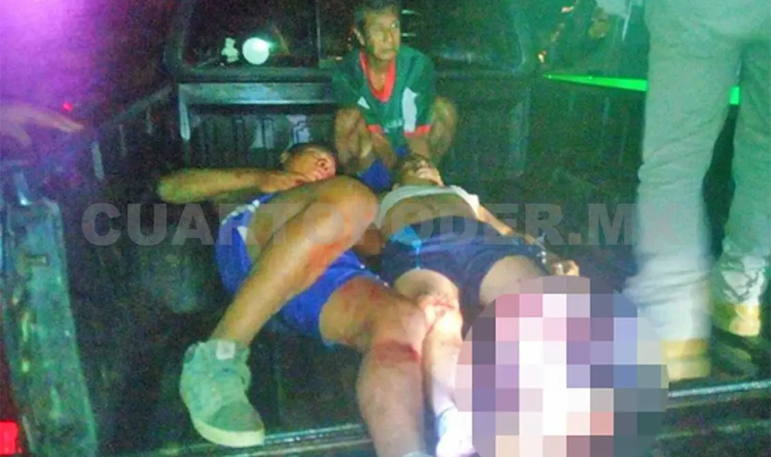 Tras accidente vial, amputan pierna a motociclista
