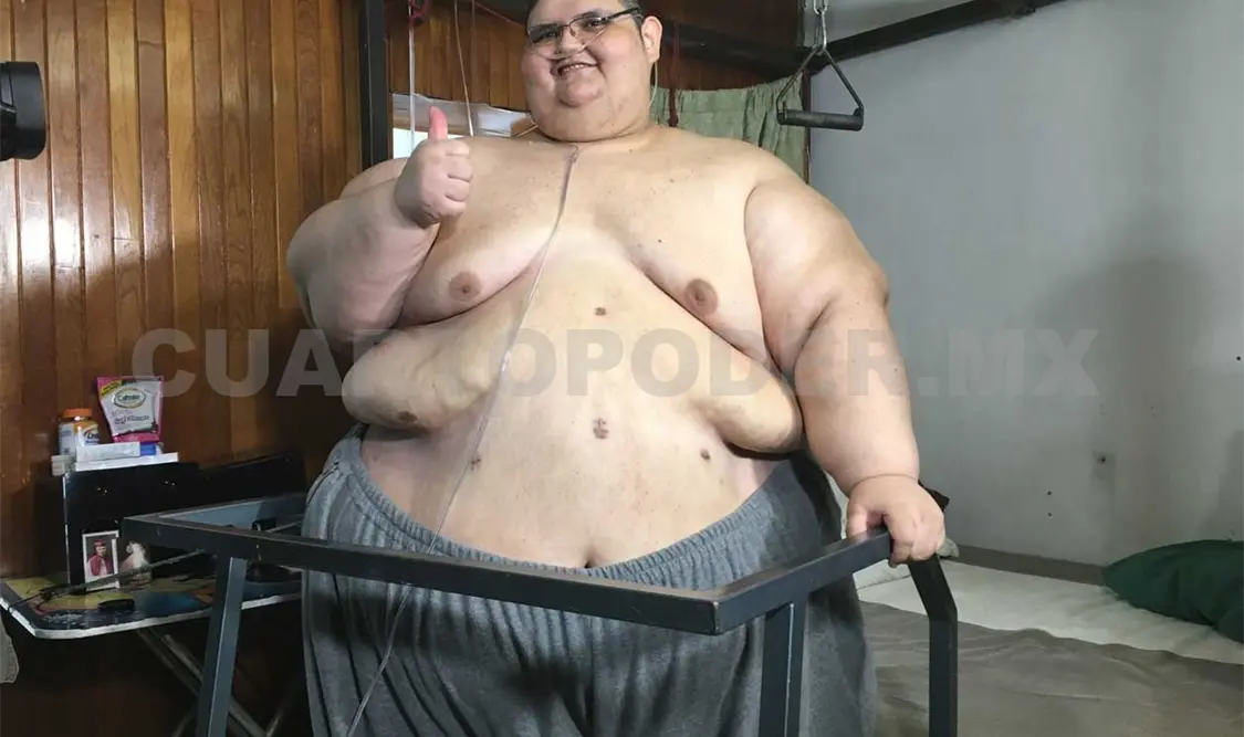 Hombre más obeso del mundo logra levantarse de la cama