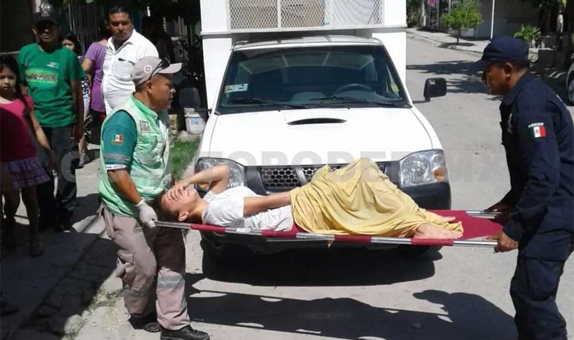 Menor quemada con “flamazo”