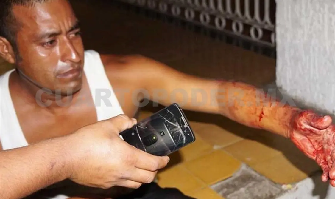 Abel fue atendido por paramédicos y luego lo trasladaron a un hospital para recibir atención especializada. Luis Castellanos / CP