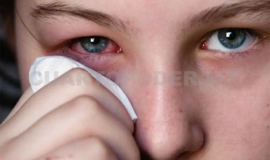 La conjuntivitis viral dura de tres a seis días. Ramón García / CP