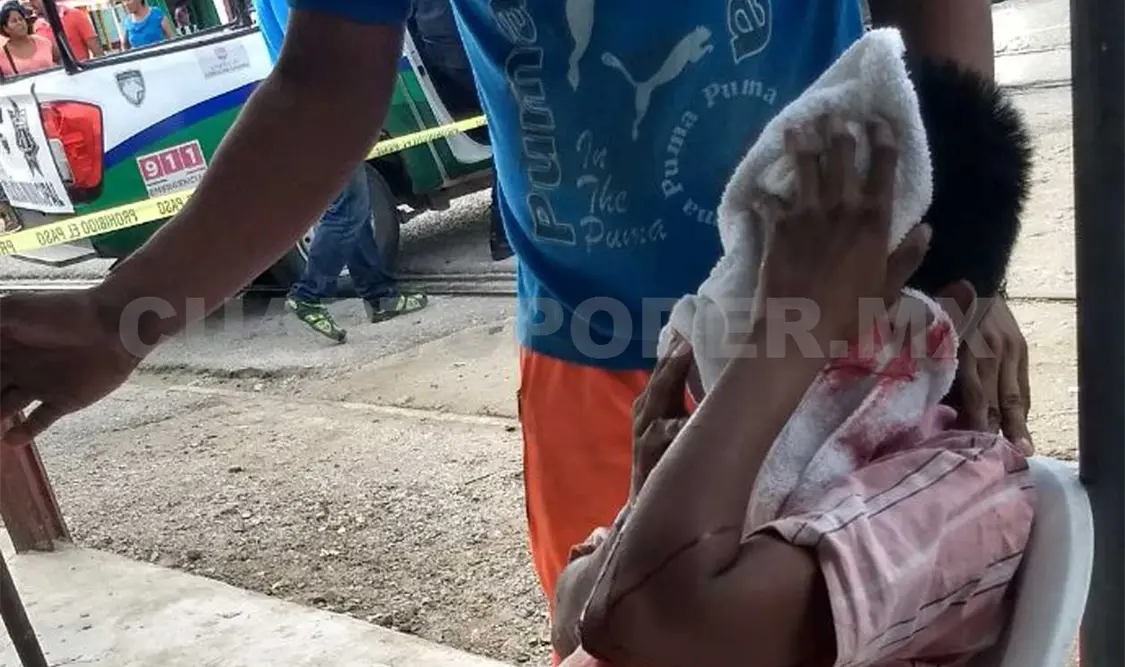 Triciclero es atacado a balazos