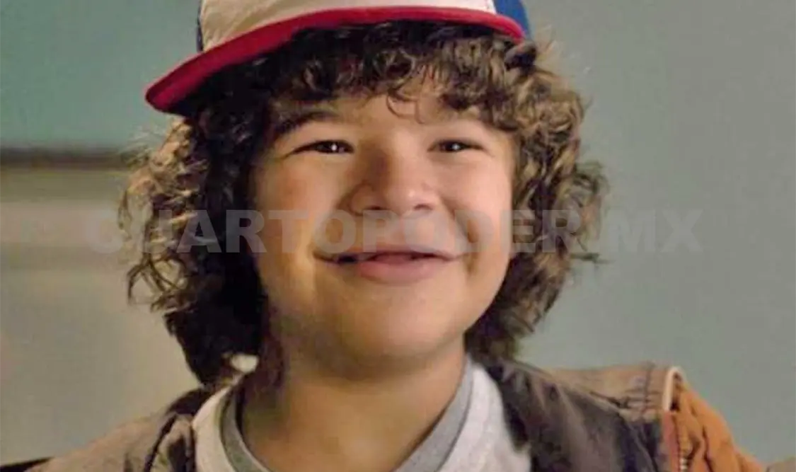 Dusty de Stranger things padece displasia
