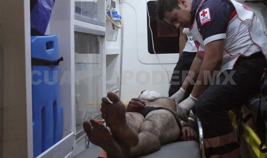 Recibió un machetazo en la cabeza en una riña