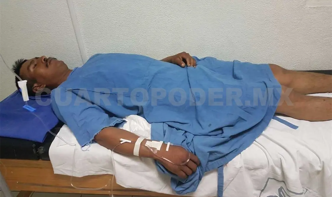 Nauyaca muerde a labriego