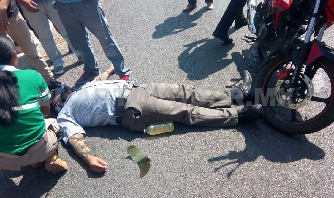 El presunto responsable se trasladaba a bordo de una motocicleta sobre la Calzada al Sumidero al momento del accidente. Edberg Mayorga / CP